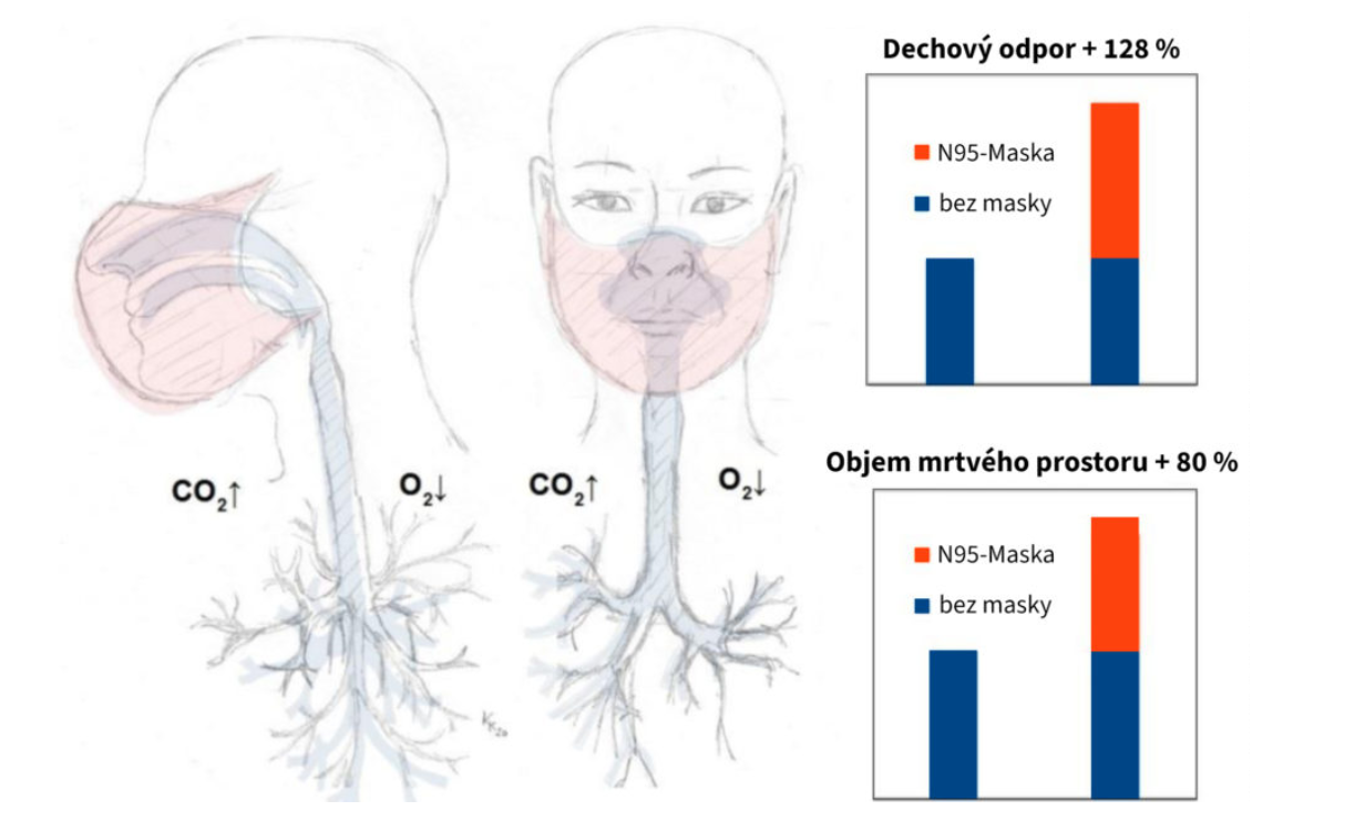 oduvodneni pro noseni respiratoru neni podlozene eresetheus